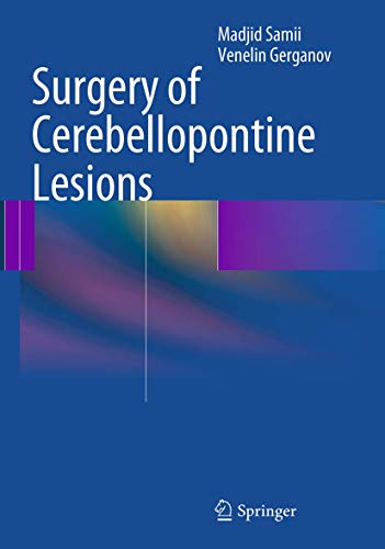 9783662521014: Surgery of Cerebellopontine Lesions