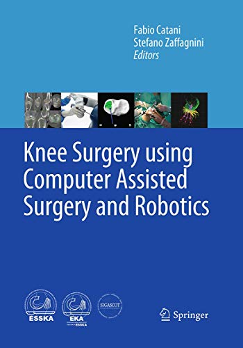9783662521311: Knee Surgery using Computer Assisted Surgery and Robotics