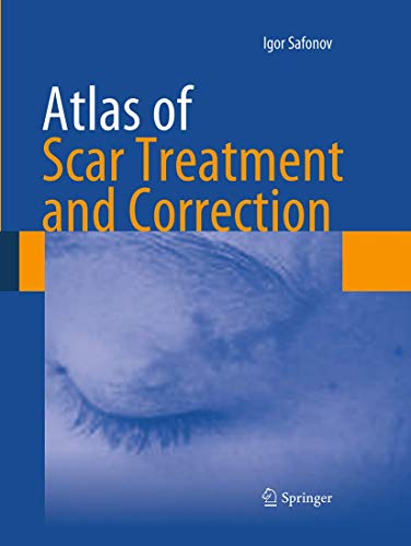 9783662521656: Atlas of Scar Treatment and Correction