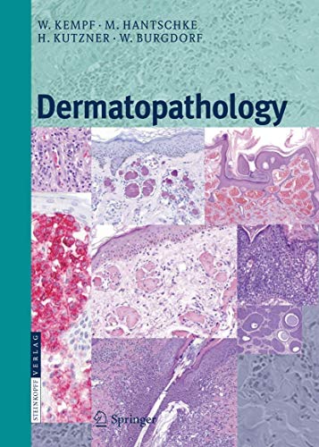 Stock image for Dermatopathology for sale by Lucky's Textbooks