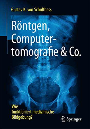 Beispielbild fr Rntgen, Computertomografie & Co.: Wie funktioniert medizinische Bildgebung? zum Verkauf von medimops