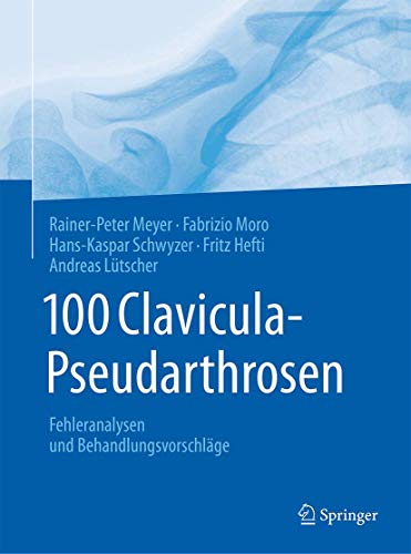 Imagen de archivo de 100 Clavicula-Pseudarthrosen. Fehleranalysen und Behandlungsvorschlge. a la venta por Gast & Hoyer GmbH