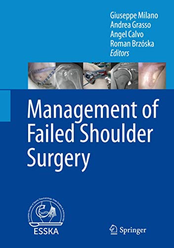 Beispielbild fr Management of Failed Shoulder Surgery zum Verkauf von Blackwell's