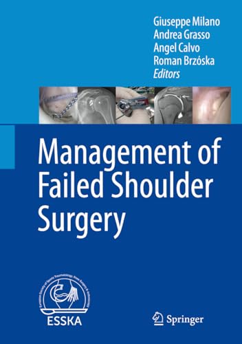 9783662565032: Management of Failed Shoulder Surgery