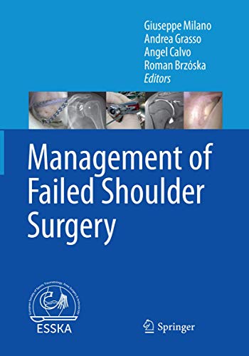 Beispielbild fr Management of Failed Shoulder Surgery zum Verkauf von Blackwell's