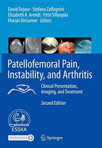 Stock image for Patellofemoral Pain, Instability, and Arthritis: Clinical Presentation, Imaging, and Treatment for sale by GF Books, Inc.