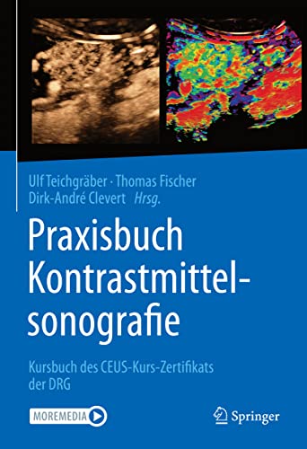 Stock image for Praxisbuch Kontrastmittelsonografie: Kursbuch des CEUS-Kurs-Zertifikats der DRG for sale by Chiron Media