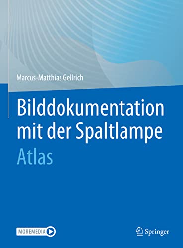 Stock image for Bilddokumentation mit der Spaltlampe (Hardcover) for sale by Grand Eagle Retail