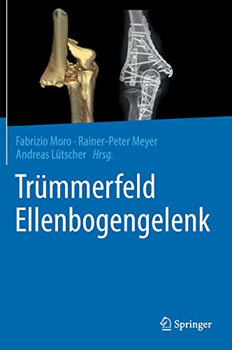 9783662645376: Trmmerfeld Ellenbogengelenk