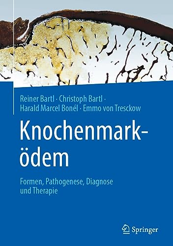 Beispielbild fr Knochenmarkdem: Formen, Pathogenese, Diagnose und Therapie (German Edition) zum Verkauf von GF Books, Inc.