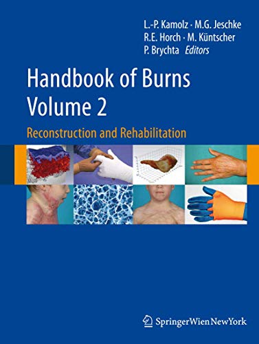 9783709103142: Handbook of Burns: Reconstruction and Rehabilitation