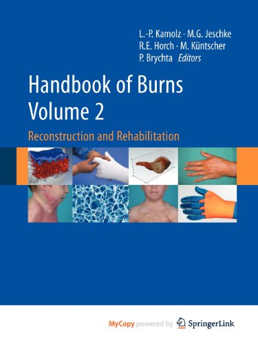 9783709103166: Handbook of Burns Volume 2: Reconstruction and Rehabilitation