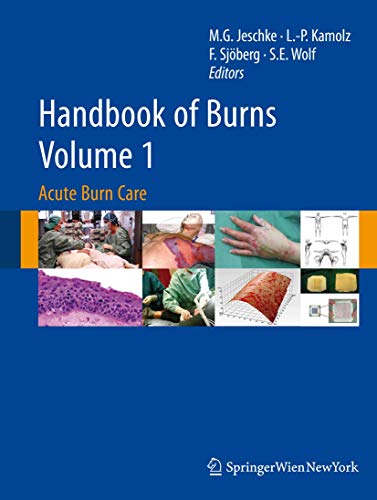 Beispielbild fr Handbook of Burns Volume 1. Acute Burn Care. zum Verkauf von Antiquariat im Hufelandhaus GmbH  vormals Lange & Springer