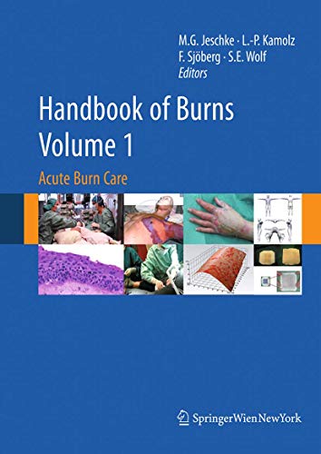 9783709119181: Handbook of Burns: Acute Burn Care