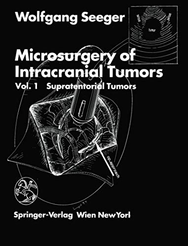 Microsurgery of Intracranial Tumors: Vol 1: Supratentorial Tumors (9783709130773) by Wolfgang Seeger