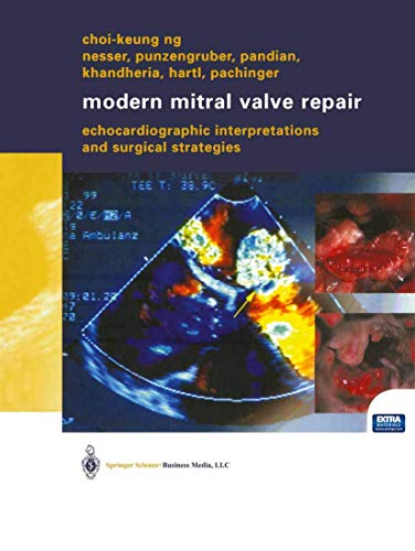 9783709137239: Modern Mitral Valve Repair: Echocardiographic Interpretations And Surgical Strategies