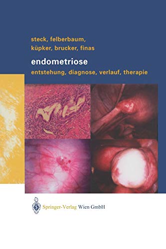9783709171967: Endometriose: Entstehung, Diagnose, Verlauf Und Therapie