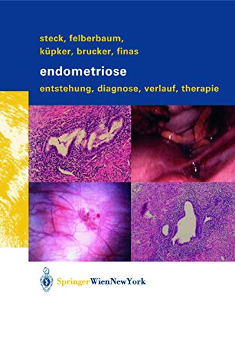 9783709171967: Endometriose: Entstehung, Diagnose, Verlauf Und Therapie
