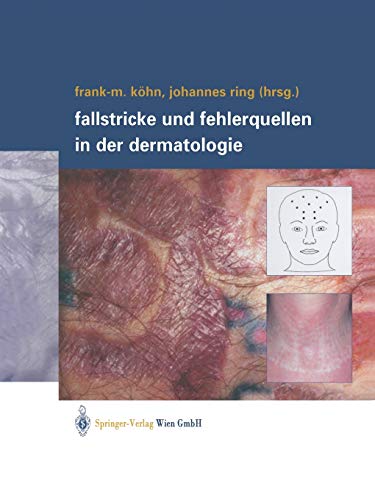 Beispielbild fr Fallstricke und Fehlerquellen in der Dermatologie (German Edition) zum Verkauf von Lucky's Textbooks
