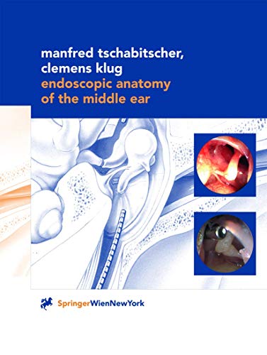 Amazon.com: Surgical Anatomy of the Internal Carotid Artery