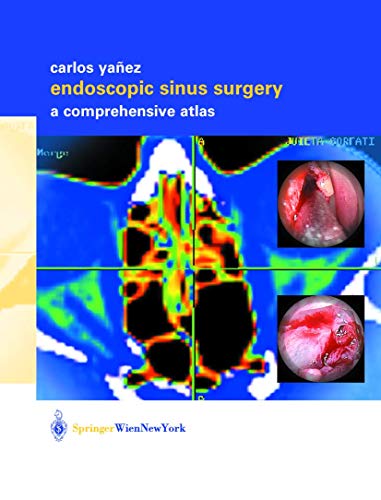 9783709172797: Endoscopic Sinus Surgery: A Comprehensive Atlas
