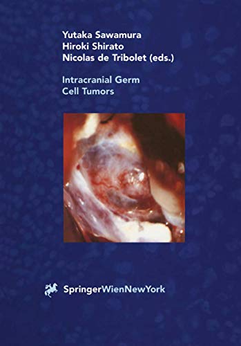 Intracranial Germ Cell Tumors - Yutaka Sawamura