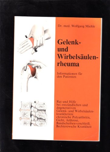 Beispielbild fr Gelenk- und Wirbelsulenrheuma - Informationen fr den Patienten zum Verkauf von medimops