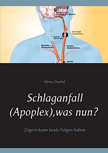 Stock image for Schlaganfall (Apoplex), was nun?: Zgern kann fatale Folgen haben (German Edition) for sale by Lucky's Textbooks