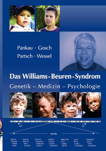 9783737543002: Das Williams-Beuren-Syndrom