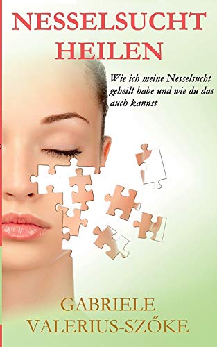 9783739219738: Nesselsucht heilen