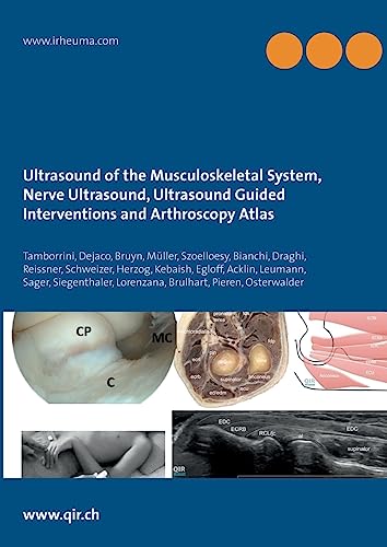 9783751998512: Ultrasound of the Musculoskeletal System, Nerve Ultrasound, Ultrasound Guided Interventions and Arthroscopy Atlas: Musculoskeletal Sonoanatomy Guidelines