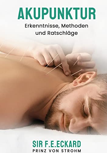 Stock image for Akupunktur : Erkenntnisse, Methoden und Ratschlge for sale by Buchpark