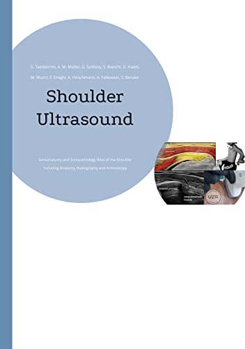 Beispielbild fr Imaging of the Shoulder: Sonoanatomy and Sonopathology Atlas of the Shoulder Including Anatomy, Radiography and Arthroscopy zum Verkauf von Revaluation Books