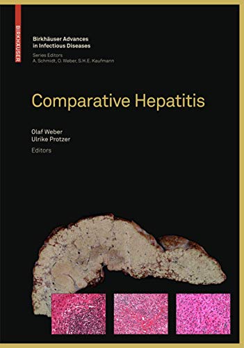 Stock image for Comparative Hepatitis. for sale by Research Ink