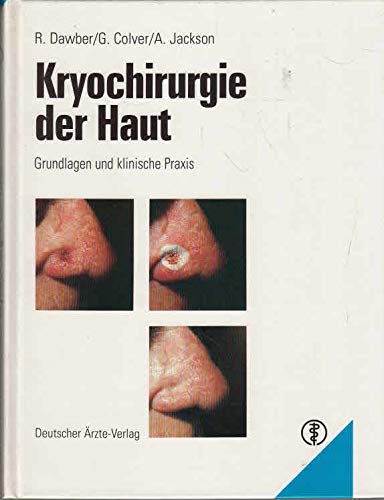 Imagen de archivo de Kryochirurgie der Haut: Grundlagen und klinische Praxis a la venta por Armoni Mediathek