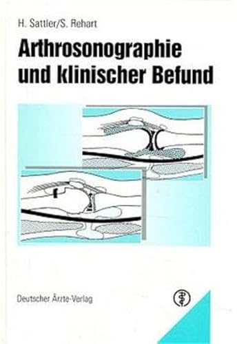 Beispielbild fr Arthrosonographie und klinischer Befund [Gebundene Ausgabe]Horst Sattler (Autor), Stefan Rehart (Autor) zum Verkauf von BUCHSERVICE / ANTIQUARIAT Lars Lutzer