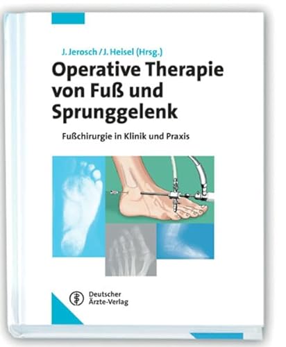 Beispielbild fr Operative Therapie von Fu und Sprunggelenk: Fuchirurgie in Klinik und Praxis zum Verkauf von medimops