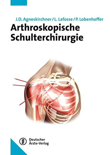 Stock image for Arthroskopische Schulterchirurgie for sale by Revaluation Books