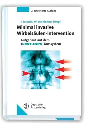 9783769105650: Ahrens, M: Minimal invasive Wirbelsulen-Intervention