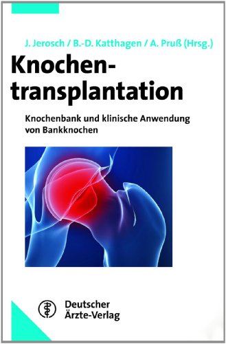 9783769106237: Knochentransplantation: Knochenbank und klinische Anwendung von Bankknochen