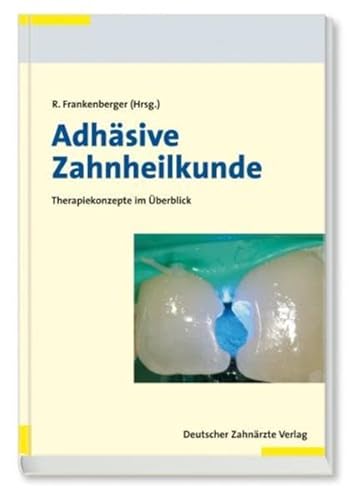 9783769134278: Adhsive Zahnheilkunde: Therapiekonzept im berblick