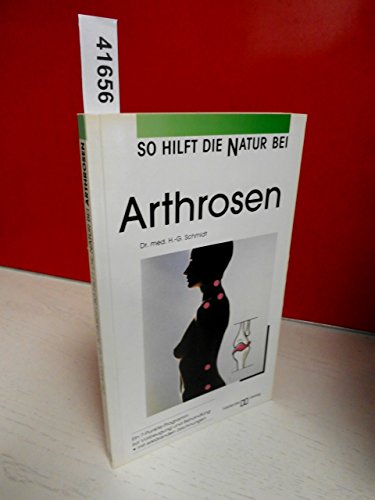 9783775001274: So hilft die Natur bei Arthrosen