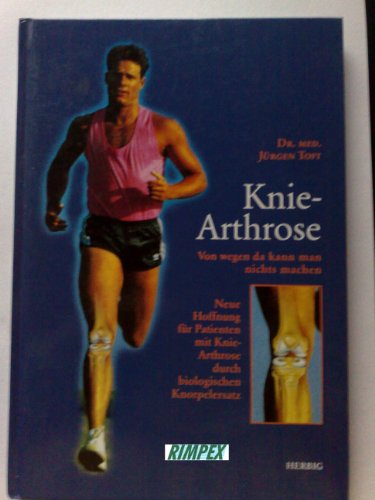 Stock image for Knie-Arthrose: Von wegen da kann man nichts machen. Neue Hoffnung für Patienten mit Knie-Arthrose durch biologischen Knorpelersatz Toft, Jürgen for sale by tomsshop.eu