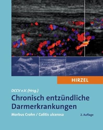 Chronisch entzündliche Darmerkrankungen: Morbus Crohn / Colitis ulcerosa - Unknown Author