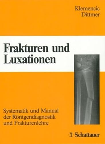 9783794515684: Frakturen und Luxationen: Systematik und Manual der Rntgendiagnostik und Frakturenlehre