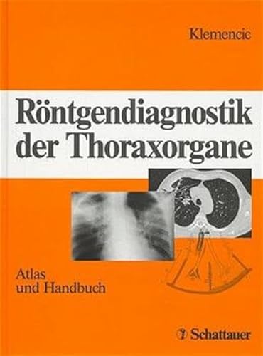 Beispielbild fr Rntgendiagnostik der Thoraxorgane von Janes Klemencic (Autor) zum Verkauf von BUCHSERVICE / ANTIQUARIAT Lars Lutzer