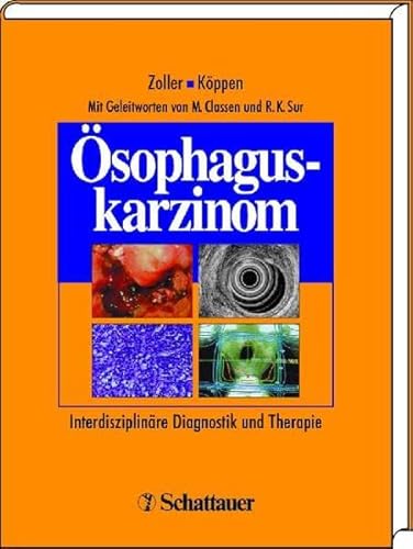 Ösophaguskarzinom Interdisziplinäre Diagnostik und Therapie