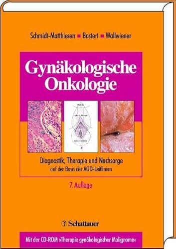 9783794521821: Gynkologische Onkologie. Mit CD-ROM: Diagnostik, Therapie und Nachsorge - auf der Basis der AGO-Leitlinien