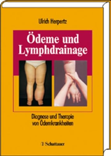 Beispielbild fr deme und Lymphdrainage: Diagnose und Therapie von demkrankheiten Ulrich Helpertz zum Verkauf von online-buch-de
