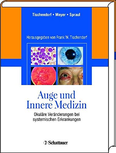 Stock image for Auge und Innere Medizin: Okulre Vernderungen bei systemischen Erkrankungen for sale by medimops